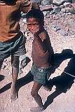 A young Nama boy in Gibeon location.